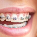 Orthodontic