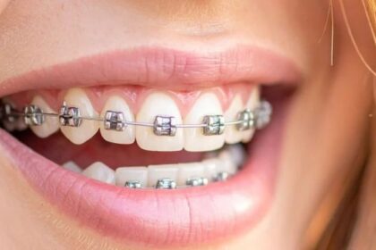 Orthodontic