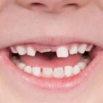 Gum