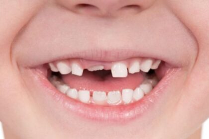 Gum