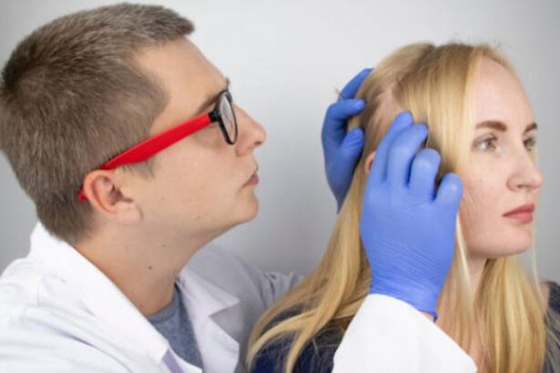 Alopecia