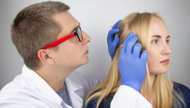 Alopecia