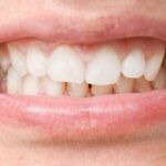 Dental