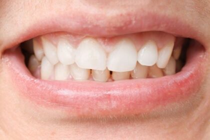 Dental