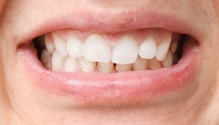 Dental