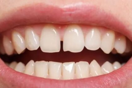 Tooth