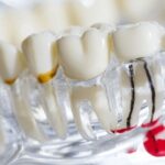 Teeth