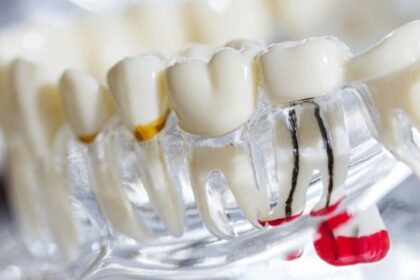 Teeth