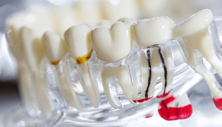 Teeth