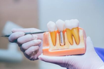 Dental