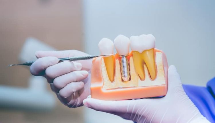 Dental