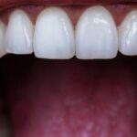 Orthodontics