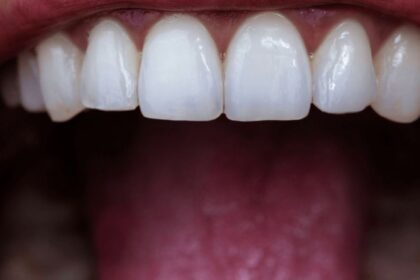 Orthodontics