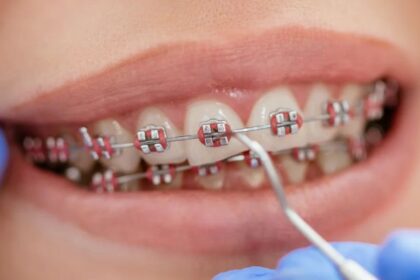 Orthodontist
