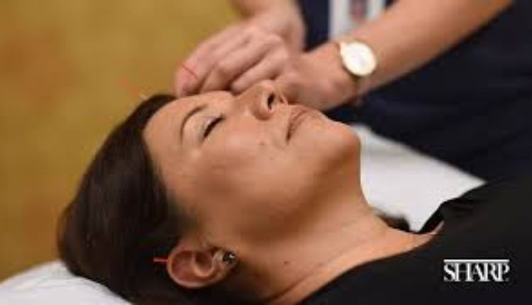 Acupuncture