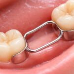 Tooth