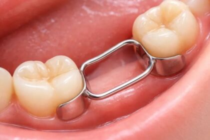 Tooth