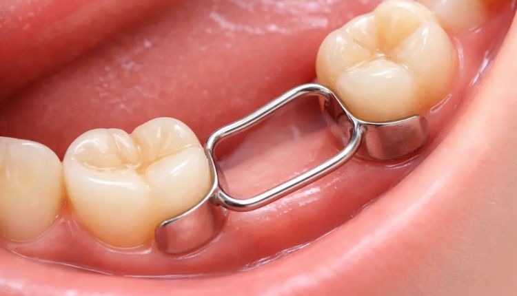 Tooth